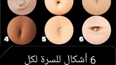 شكل السرة