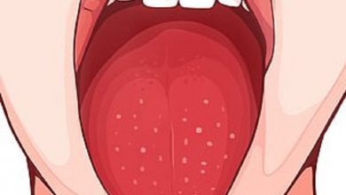 نقص البوتاسيوم