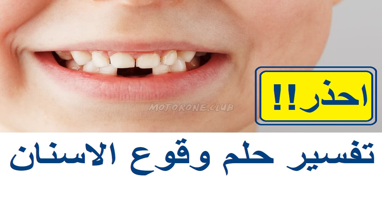 تفسير حلم وقوع الاسنان