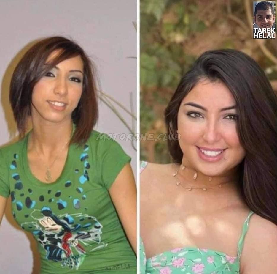 دنيا بطمة